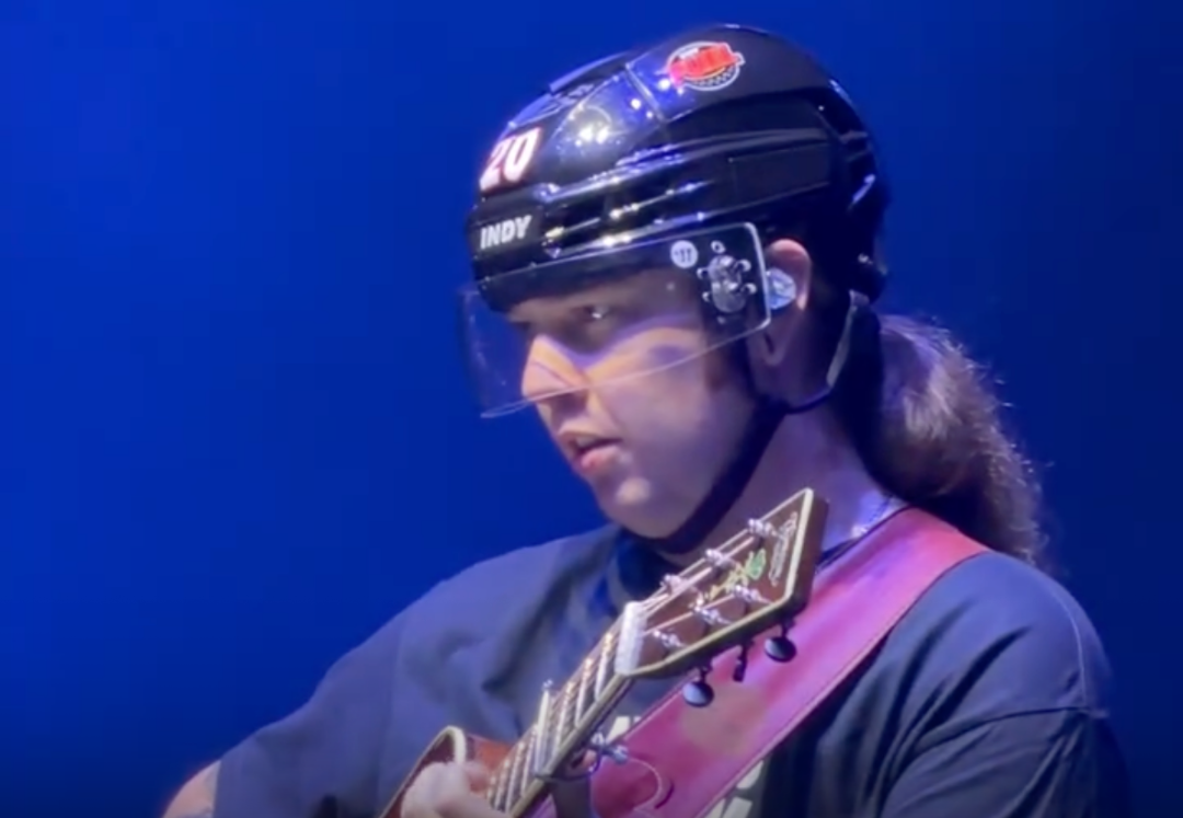 Billy Strings Wears Protective Headgear After Getting Hit By Object The Previous Night — image 4
